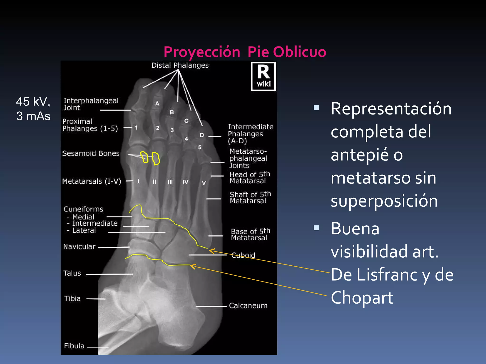 Proyecciones Radiologicas Miembro Inferior | PPT