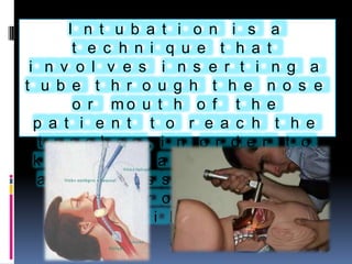 INTUBACION ENDOTRAQUEAL | PPTX