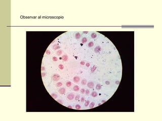 Observar al microscopio
 