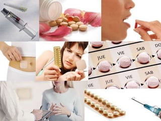 Métodos homonales
• Pildoras: inhiben la ovulacion y dificultan el
desplazamiento de los espermatozoides
• Inyecciones (existen de dos tipos):
• Compuestas: se combina la accion de la progesterona y
estrogenos.
• Progestina: Solo contienen progesterona.
• Parche: Libera hormonas sobre la piel que inhiben la
ovulacion
• Implante subdérmico: inhibe la ovulacion
 