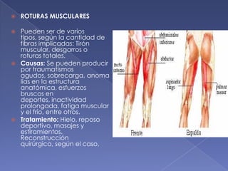 ROTURAS MUSCULARES Pueden ser de varios tipos, según la cantidad de fibras implicadas: Tirón muscular, desgarros o roturas totales. Causas: Se pueden producir por traumatismos agudos, sobrecarga, anomalías en la estructura anatómica, esfuerzos bruscos en deportes, inactividad prolongada, fatiga muscular y el frío, entre otros. Tratamiento: Hielo, reposo deportivo, masajes y estiramientos. Reconstrucción quirúrgica, según el caso.  