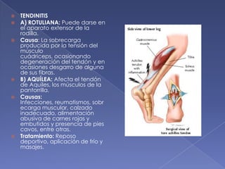 TENDINITIS  A) ROTULIANA: Puede darse en el aparato extensor de la rodilla. Causa: La sobrecarga producida por la tensión del músculo cuádriceps, ocasionando degeneración del tendón y en ocasiones desgarro de alguna de sus fibras. B) AQUÍLEA: Afecta el tendón de Aquiles, los músculos de la pantorrilla.Causas: Infecciones, reumatismos, sobrecarga muscular, calzado inadecuado, alimentación abusiva de carnes rojas y embutidos y presencia de pies cavos, entre otras.Tratamiento: Reposo deportivo, aplicación de frío y masajes.  