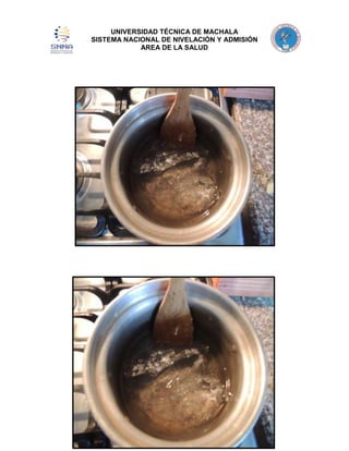 UNIVERSIDAD TÉCNICA DE MACHALA
SISTEMA NACIONAL DE NIVELACIÓN Y ADMISIÓN
AREA DE LA SALUD

 