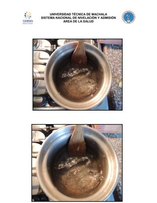 UNIVERSIDAD TÉCNICA DE MACHALA
SISTEMA NACIONAL DE NIVELACIÓN Y ADMISIÓN
AREA DE LA SALUD

 