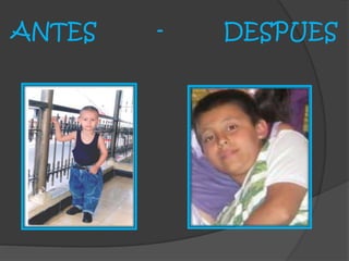 ANTES - DESPUES
 