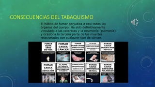 CONSECUENCIAS DEL TABAQUISMO
El hábito de fumar perjudica a casi todos los
órganos del cuerpo. Ha sido definitivamente
vinculado a las cataratas y la neumonía (pulmonía)
y ocasiona la tercera parte de las muertes
relacionadas con cualquier tipo de cáncer.