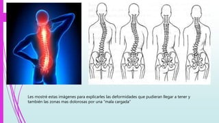 Les mostré estas imágenes para explicarles las deformidades que pudieran llegar a tener y
también las zonas mas dolorosas por una “mala cargada”
 