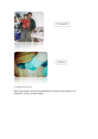 8. BIBLIOGRAFÍA
https://sites.google.com/site/universidadybuenvivirespe/b-conociendome-a-mi-
mismo/b2---yo-soy-mi-mejor-trabajo
Yo de pequeña
Mi lesión
 