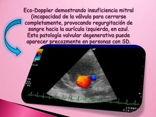 Las primeras son las que transmiten de padres a hijos a través de los genes.Las segundas resultan de alguna mutación o alteración en los genes o en los cromosomas. Enfermedades genéticas