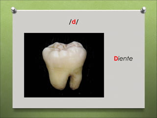 /d/




      Diente
 