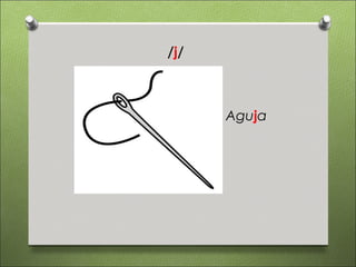 /j/



      Aguja
 