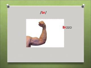 /br/



       Brazo
 