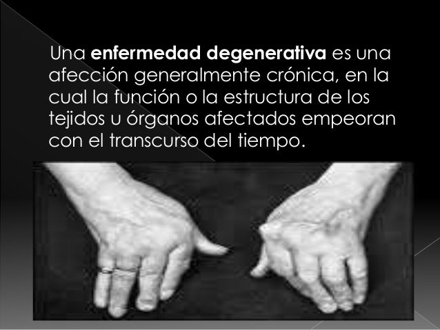 Los geles eficaces las cremas a la osteocondrosis