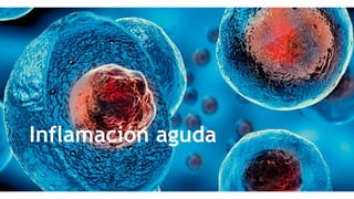 Inflamación aguda
 