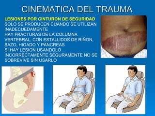 Curso Cinematica del Trauma Hospital Cafayate | PPT