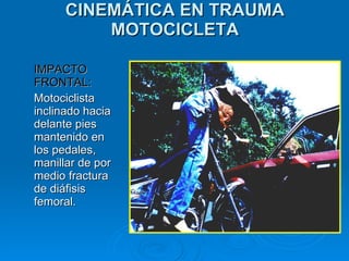 Curso Cinematica del Trauma Hospital Cafayate | PPT