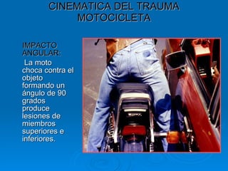 Curso Cinematica del Trauma Hospital Cafayate | PPT