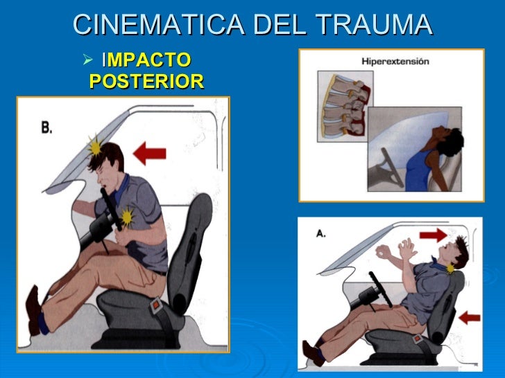 Curso Cinematica del Trauma Hospital Cafayate