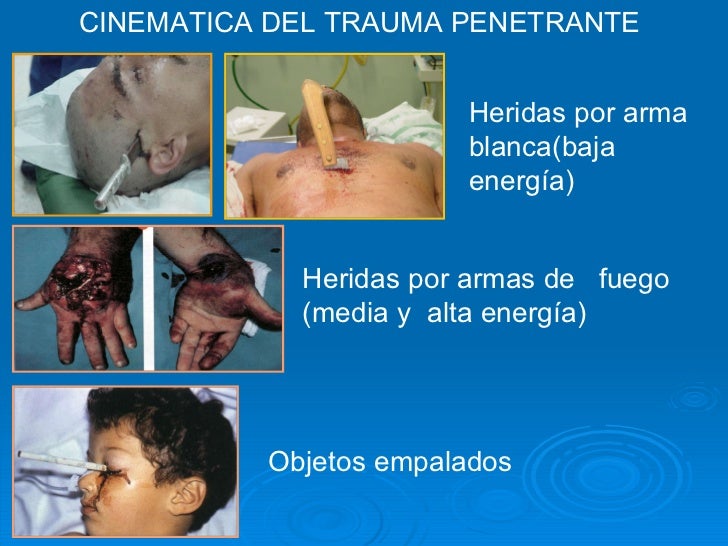 cinematica de trauma definicion