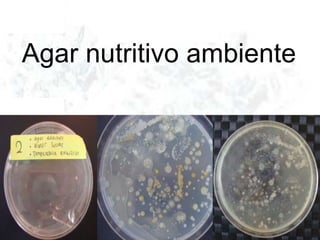 Agar nutritivo ambiente