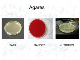 Agares
PAPA SANGRE NUTRITIVO