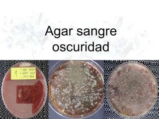 Agar sangre
oscuridad