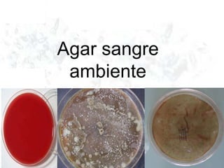 Agar sangre
ambiente