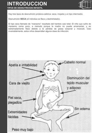 INTRODUCCION
TIPOS DE DESNUTRICION INFANTIL
Hay tres tipos de desnutrición proteico-calórica: seca, mojada y un tipo intermedio.
Desnutrición SECA (el individuo es flaco y deshidratado).
El tipo seco llamado de “marasmo” resultado del hambre casi total. El niño que sufre de
marasmo come poco, a menudo porque la madre no puede amamantar, y es
extremadamente flaco debido a la pérdida de grasa corporal y músculo. Casi
invariablemente, estos niños desarrollan alguna clase de infección.
INTRODUCCION
TIPOS DE DESNUTRICION INFANTIL
 