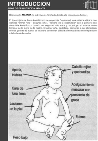 INTRODUCCION
TIPOS DE DESNUTRICION INFANTIL
Desnutrición MOJADA (el individuo es hinchado debido a la retención de fluidos).
El tipo mojado se llama kwashiorkor (se pronuncia Cuasiorcor), una palabra africana que
significa “primer niño – segundo niño”. Proviene de la observación que el primero niño
desarrolla kwashiorkor cuando un segundo niño nace y substituye el anterior como
tomador de la leche de la madre. El primer niño, destetado, comienza a ser alimentado
con las gachas de avena, de la avena que tienen calidad alimenticia baja en comparación
a la leche de la madre.
INTRODUCCION
TIPOS DE DESNUTRICION INFANTIL
 
