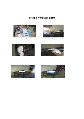 PRIMER PROCEDIMIENTO
 