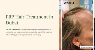 PRP Hair Treatment in
Dubai
PRP Hair Treatment is a natural and innovative procedure designed to
combat hair loss and promote hair regrowth. Our team of hair experts in
Dubai will help you restore your hair to its former glory.
 