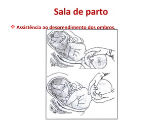 Sala de parto Assistência ao desprendimento dos ombros . 