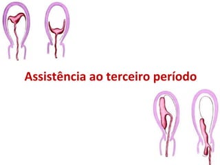 Assistência ao terceiro período 