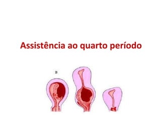 Assistência ao quarto período 