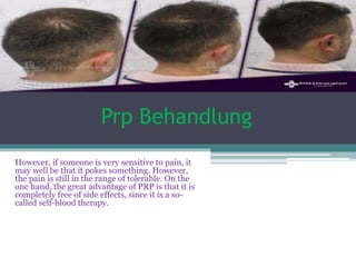 Prp Behandlung
However, if someone is very sensitive to pain, it
may well be that it pokes something. However,
the pain is still in the range of tolerable. On the
one hand, the great advantage of PRP is that it is
completely free of side effects, since it is a so-
called self-blood therapy.
 