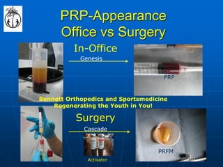 PRP-Appearance Office vs Surgery 
Genesis 
Cascade 
PRP 
PRFM 
Activator 
In-Office 
Surgery 
Bennett Orthopedics and Sportsmedicine 
Regenerating the Youth in You! 
copyright 2012  