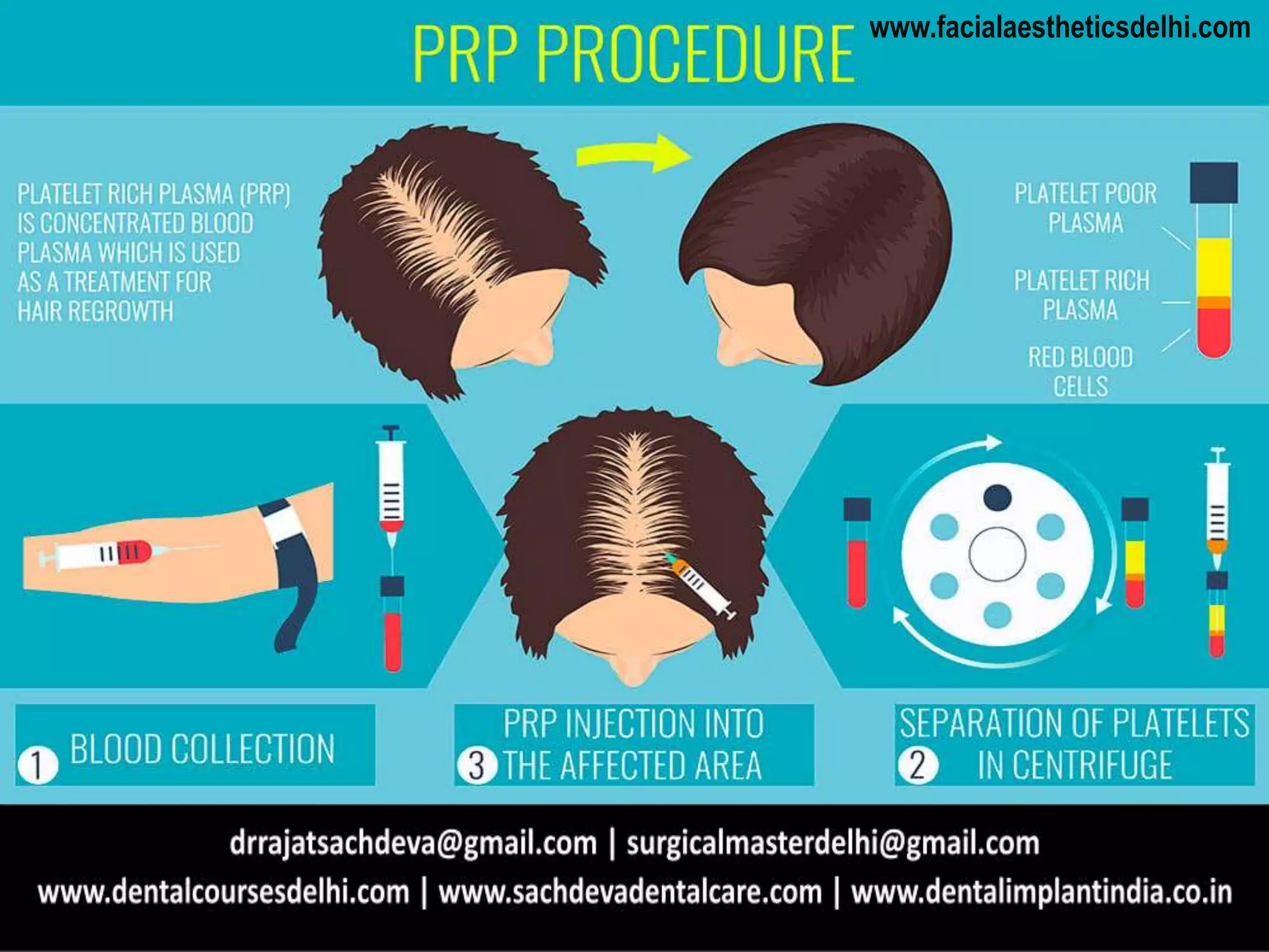 Prp for hair regrowth | PPTX