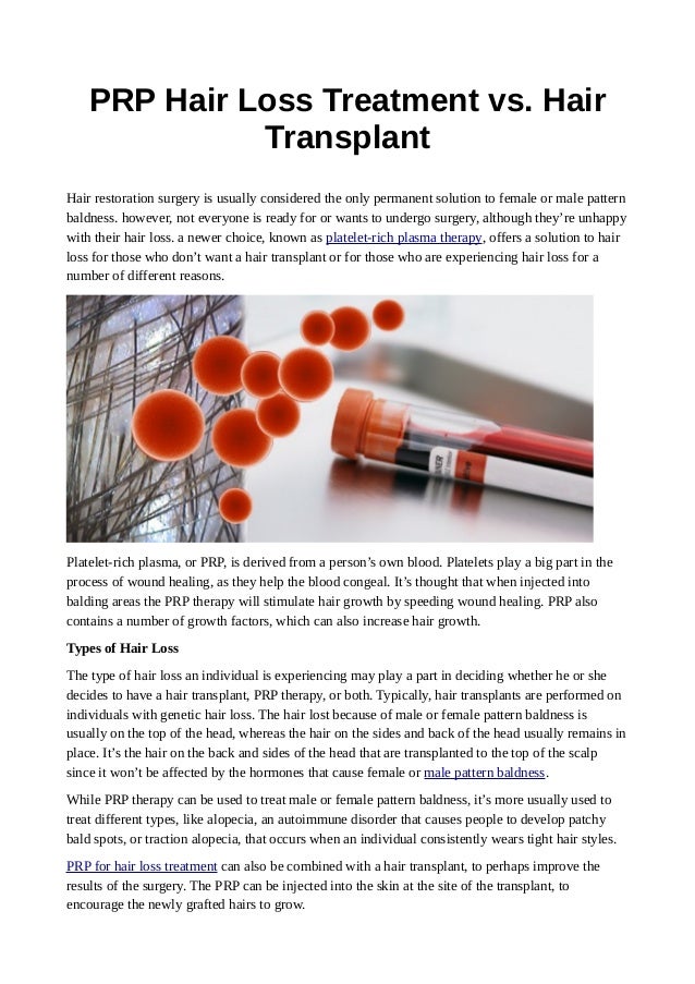 Prp hair loss treatment vs. hair transplant
