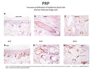 PRP_How_to_enhance_the_results (1).pptx