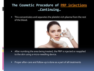 PRP Injections | PPTX