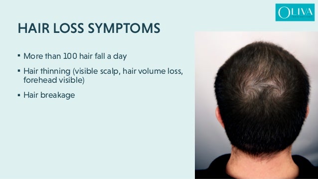Hair Loss Hair Loss Treatments Best Treatment For Hair Regrowth