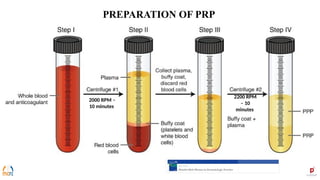 PRP, STEM CELLS & 3D PRINTING FOR NON – HEALING ULCERS.pptx