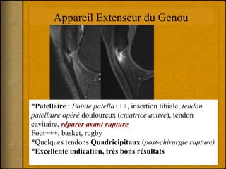 Appareil Extenseur du Genou 
*Patellaire : Pointe patella+++, insertion tibiale, tendon 
patellaire opéré douloureux (cicatrice active), tendon 
cavitaire, réparer avant rupture 
Foot+++, basket, rugby 
*Quelques tendons Quadricipitaux (post-chirurgie rupture) 
*Excellente indication, très bons résultats 
 