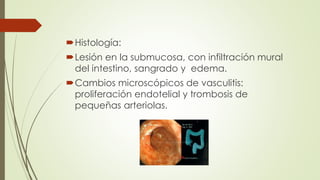 Histología:
Lesión en la submucosa, con infiltración mural
del intestino, sangrado y edema.
Cambios microscópicos de vasculitis:
proliferación endotelial y trombosis de
pequeñas arteriolas.
 