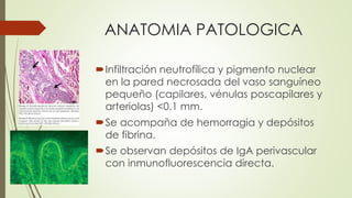 ANATOMIA PATOLOGICA
Infiltración neutrofílica y pigmento nuclear
en la pared necrosada del vaso sanguíneo
pequeño (capilares, vénulas poscapilares y
arteriolas) <0.1 mm.
Se acompaña de hemorragia y depósitos
de fibrina.
Se observan depósitos de IgA perivascular
con inmunofluorescencia directa.
 