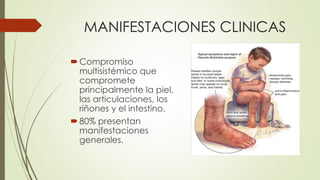 MANIFESTACIONES CLINICAS
Compromiso
multisistémico que
compromete
principalmente la piel,
las articulaciones, los
riñones y el intestino.
80% presentan
manifestaciones
generales.
 