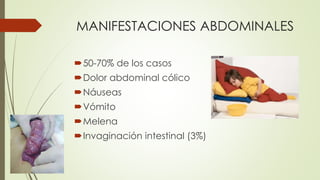 MANIFESTACIONES ABDOMINALES
50-70% de los casos
Dolor abdominal cólico
Náuseas
Vómito
Melena
Invaginación intestinal (3%)
 