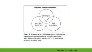 Nefrologia 2013;33(1):27-45
 