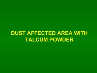 DUST AFFECTED AREA WITH TALCUM POWDER 