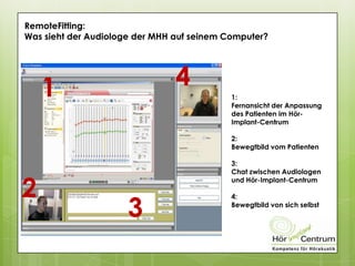 RemoteFitting:
Was sieht der Audiologe der MHH auf seinem Computer?
1:
Fernansicht der Anpassung
des Patienten im Hör-
Implant-Centrum
2:
Bewegtbild vom Patienten
3:
Chat zwischen Audiologen
und Hör-Implant-Centrum
4:
Bewegtbild von sich selbst
1
2
3
4
 
